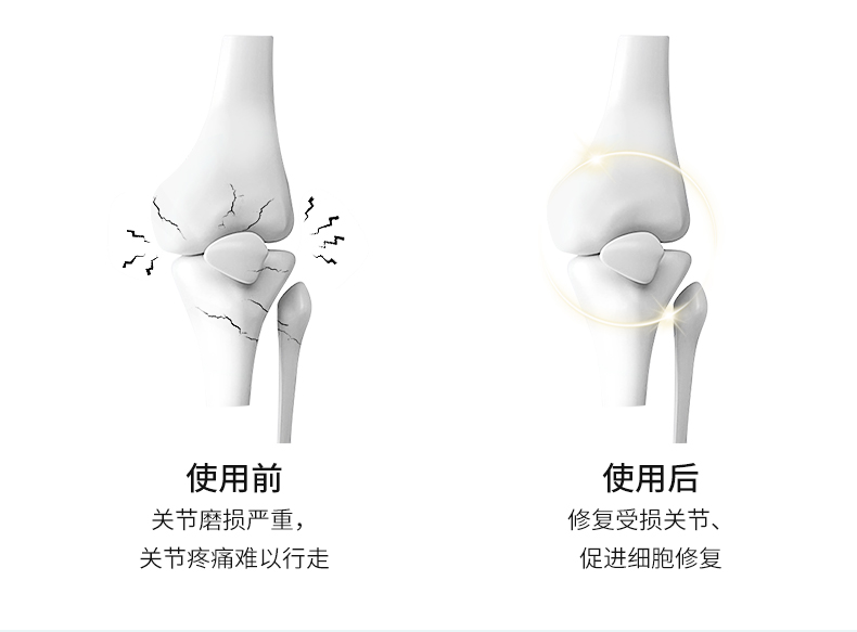 關(guān)節(jié)舒緩保護(hù)劑_04.jpg